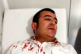 Kendini bilmez bir vatandaş Halil İbrahim uğur'u kanlar içinde bıraktı.