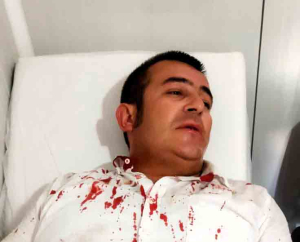 Kendini bilmez bir vatandaş Halil İbrahim uğur'u kanlar içinde bıraktı.