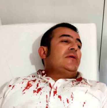 Kendini bilmez bir vatandaş Halil İbrahim uğur'u kanlar içinde bıraktı.